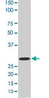 PAB0394 - 14-3-3 protein epsilon