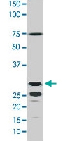 PAB0394 - 14-3-3 protein epsilon