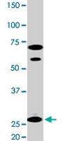 PAB0395 - 14-3-3 protein epsilon