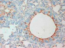 PAB12275 - MMP-8