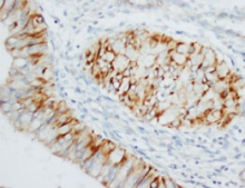 PAB12275 - MMP-8