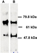 PAB12561 - ABCE1