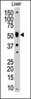PAB4797 - MMP-8