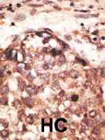 PAB4797 - MMP-8