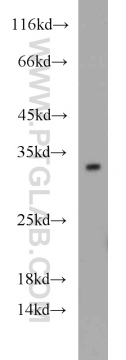 12381-1-AP - 14-3-3 protein gamma