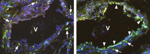 Fig. 2: Immunofluorescence staining (green) using a polyclonal antibody directed against the C-terminal end of native soluble VEGFR-1/Flt-1 Cat.-No. DP3522 (2a) and a monoclonal antibody directed against the extracellular domain of the membrane-bound VEGFR-1/Flt-1 Cat.-No. DM3507 (2b). Two neighboring sections of a Human Vein (V), located near a hemangioma, are visualized. The antibody against the soluble VEGFR-1/Flt-1 marked single cells (arrows) within the media and adventitia of the vein. The antibody against the membrane-bound VEGFR-1/Flt-1 marked single cells (arrows) and the endothelium (arrowhead) of the vein. Cell nuclei are stained with Dapi (blue).The experiment was performed by K. Butler and J. Wilting, University Göttingen, Germany Fig. 2: Immunofluorescence staining (green) using a polyclonal antibody directed against the C-terminal end of native soluble VEGFR-1/Flt-1 Cat.-No. DP3522 (2a) and a monoclonal antibody directed against the extracellular domain of the membrane-bound VEGFR-1/Flt-1 Cat.-No. DM3507 (2b). Two neighboring sections of a Human Vein (V), located near a hemangioma, are visualized. The antibody against the soluble VEGFR-1/Flt-1 marked single cells (arrows) within the media and adventitia of the vein. The antibody against the membrane-bound VEGFR-1/Flt-1 marked single cells (arrows) and the endothelium (arrowhead) of the vein. Cell nuclei are stained with Dapi (blue).The experiment was performed by K. Butler and J. Wilting, University Göttingen, Germany