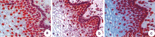 Fig. 1: Immunostaining of human epidermis with: a) lamin A antibody Cat.-No. BM4500; b) lamin B1 antibody Cat.-No. BM4501; c) lamin B2 antibody Cat.-No. BM4502