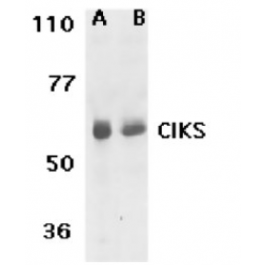SP1316P