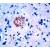 Formalin fixed paraffin embedded human Alzheimers brain stained with Amyloid precursor protein antibody DP123 / DP123-05