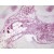 Figure 3. Sample of the transition zone in human hip osteonecrosiss: A 1/500 dilution of AP02087SU was incubated 4h at room temprature with fixed cells (with permission from J Orthop Res (Radke et al., 2006).