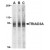 Western blot analysis of TRIAD3A in mouse heart cell lysates with TRIAD3A antibody at (A) 0.5, (B) 1, and (C) 2 µg/ml