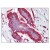 Figure 1. Formalin-Fixed Paraffin-Embedded (FFPE) on Breast.