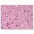 AP07606PU-N NF2 antibody staining of Formalin-Fixed Paraffin-Embedded Human Brain, cortex at 2.5 µg/ml followed by biotinylated goat anti-rabbit IgG secondary antibody, alkaline phosphatase-streptavidin and chromogen.