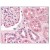 AP07641PU-N TFAP2A antibody staining of Formalin-Fixed Paraffin-Embedded Human Kidney at 2.5 µg/ml followed by biotinylated anti-Goat IgG secondary antibody, Alkaline Phosphatase-Streptavidin and Chromogen.