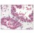 Figure 1. Formalin-Fixed Paraffin-Embedded (FFPE) on Prostate.