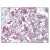 AP07688PU-N CARD9 antibody staining of Formalin-Fixed Paraffin-Embedded Human Adrenal at 10 µg/ml followed by biotinylated Goat anti-Rabbit IgG secondary antibody, alkaline phosphatase-streptavidin and chromogen.