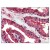 Figure 1. Formalin-Fixed Paraffin-Embedded (FFPE) on Prostate.