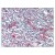 AP07694PU-N DC-SIGN antibody staining Formalin-Fixed Paraffin-Embedded Human Tonsil at 5 µg/ml followed by biotinylated Goat anti-Rabbit IgG secondary antibody, Alkaline Phosphatase-Streptavidin and Chromogen.