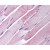 Skeletal Muscle: Formalin-Fixed Paraffin-Embedded (FFPE)