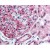 Kidney: Formalin-Fixed Paraffin-Embedded (FFPE)