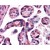 Placenta: Formalin-Fixed Paraffin-Embedded (FFPE)