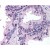 Prostate: Formalin-Fixed Paraffin-Embedded (FFPE)