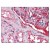 AP07746PU-N EDA2R antibody staining of Formalin-Fixed Paraffin-Embedded Human Kidney at 2.5 µg/ml followed by biotinylated goat anti-rabbit IgG secondary antibody, alkaline phosphatase-streptavidin and chromogen.