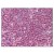 Spleen: Formalin-Fixed Paraffin-Embedded (FFPE)