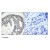 Figure 1. Immunohistochemical analysis of paraffin-embedded human breast carcinoma tissue using Phospho-Ser1177 eNOS antibody (#AP08011PU)