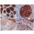 Immunohistochemistry staining (paraffin-embedded sections) using anti-Cbp/PAG (MEM-255). Cbp/PAG is expressed in germinal centers of lymph node lymphoid follicle and in follicular lymphoma (it is absent from mantle zone). Cbp/PAG is also expressed more weakly in T cells in tonsil and the thymic medulla.