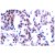 Immunohistochemistry (IHC) analysis of JunB pSer259 antibody (Cat.-No.: AP01622PU-N) in paraffin-embedded human breast carcinoma tissue.