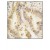 Figure 2. Formalin-fixed and paraffin-embedded human lung carcinoma tissue reacted with SOD2 Monoclonal Antibody (Cat.#AM11059PU-N), which was peroxidase-conjugated to the secondary antibody, followed by DAB staining. This data demonstrates the use of this antibody for immunohistochemistry. Clinical relevance has not been evaluated.