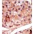 Formalin-fixed and paraffin-embedded human cancer tissue reacted with the primary antibody, which was peroxidase-conjugated to the secondary antibody, followed by DAB staining.