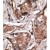 Formalin-fixed and paraffin-embedded human cancer tissue reacted with the primary antibody, which was peroxidase-conjugated to the secondary antibody, followed by DAB staining. This data demonstrates the use of this antibody for immunohistochemistry; clinical relevance has not been evaluated.