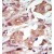 Formalin-fixed and paraffin-embedded human cancer tissue reacted with the primary antibody, which was peroxidase-conjugated to the secondary antibody, followed by DAB staining.