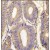Formalin-fixed and paraffin-embedded human colon carcinoma tissue reacted with PAK1 Antibody, which was peroxidase-conjugated to the secondary antibody, followed by DAB staining.