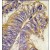 Formalin-fixed and paraffin-embedded human colon carcinoma tissue reacted with PHLPP2 antibody (N-term), which was peroxidase-conjugated to the secondary antibody, followed by DAB staining.