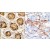(LEFT)Formalin-fixed and paraffin-embedded human colon carcinoma reacted with PDGFRL antibody (C-term), which was peroxidase-conjugated to the secondary antibody, followed by DAB staining. (RIGHT)Formalin-fixed and paraffin-embedded human cancer tissue reacted with the primary antibody, which was peroxidase-conjugated to the secondary antibody, followed by DAB staining.