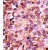 Formalin-fixed and paraffin-embedded human cancer tissue reacted with the primary antibody, which was peroxidase-conjugated to the secondary antibody, followed by AEC staining.