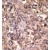 Formalin-fixed and paraffin-embedded human cancer tissue reacted with the primary antibody, which was peroxidase-conjugated to the secondary antibody, followed by DAB staining.