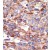 Formalin-fixed and paraffin-embedded human cancer tissue reacted with the primary antibody, which was peroxidase-conjugated to the secondary antibody, followed by DAB staining. This data demonstrates the use of this antibody for immunohistochemistry; clinical relevance has not been evaluated.