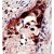 Formalin-fixed and paraffin-embedded human cancer tissue reacted with the primary antibody, which was peroxidase-conjugated to the secondary antibody, followed by AEC staining. This data demonstrates the use of this antibody for immunohistochemistry; clinical relevance has not been evaluated.