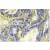 Immunohistochemistry analysis of PERK antibody (Cat.-No.: AP06757PU-N) on paraffin-embedded sections