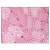 Skeletal muscle: Formalin-Fixed Paraffin-Embedded (FFPE)