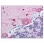 Brain, cerebellum: Formalin-Fixed Paraffin-Embedded (FFPE)