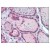 Thyroid: Formalin-Fixed Paraffin-Embedded (FFPE)
