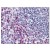 Spleen: Formalin-Fixed Paraffin-Embedded (FFPE)