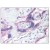 Placenta: Formalin-Fixed Paraffin Embedded (FFPE)
