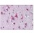 Brain, cortex: Formalin-Fixed Paraffin Embedded (FFPE)