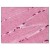 Skeletal muscle: Formalin-Fixed Paraffin-Embedded (FFPE)